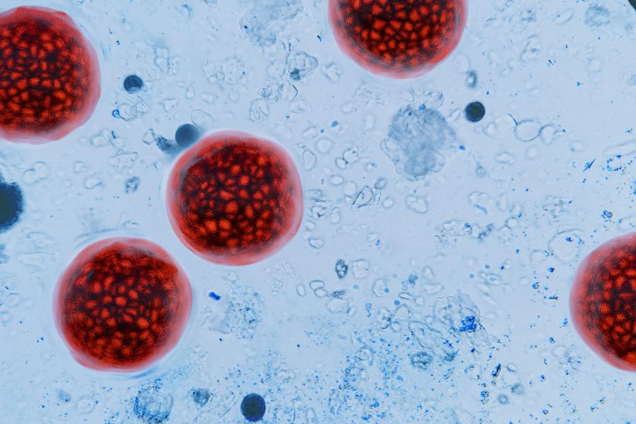 Image of cells